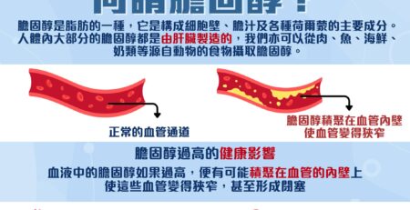 膽固醇大迷思 1