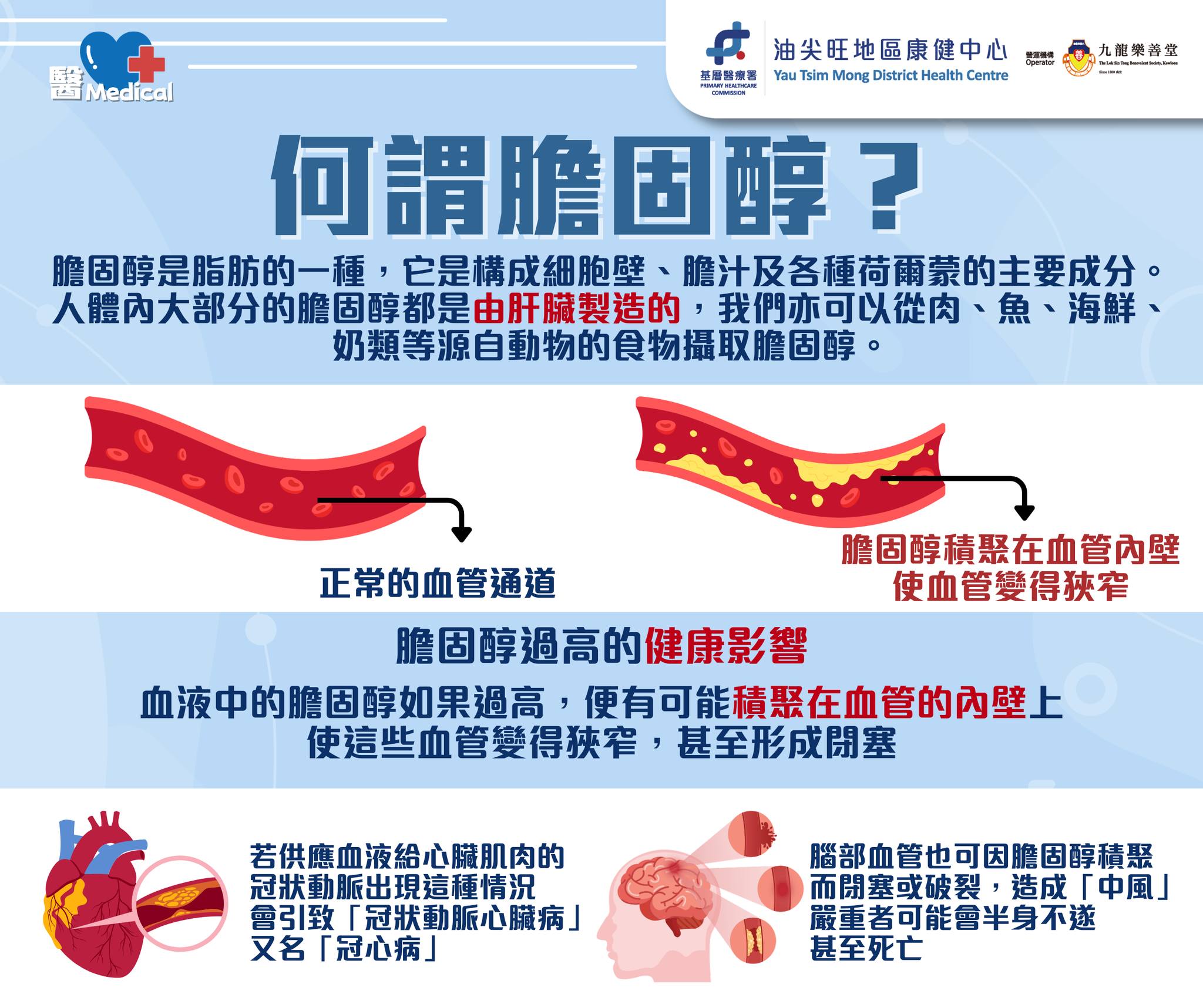 膽固醇大迷思 1